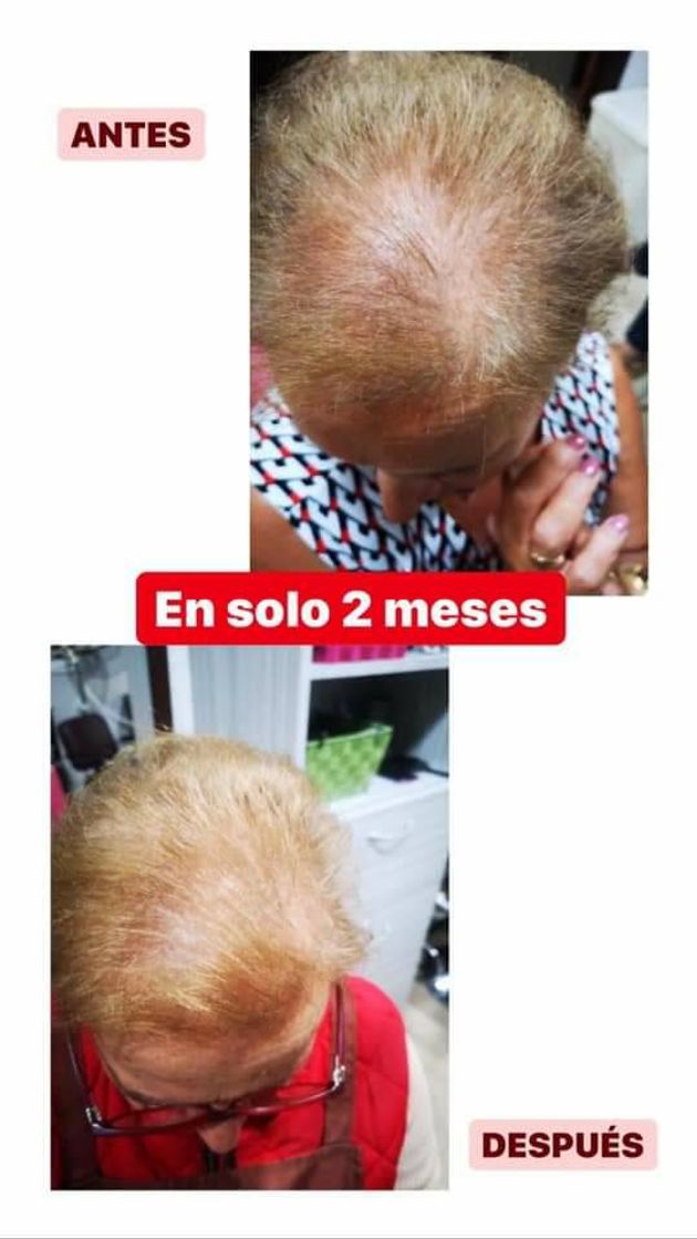 Product Cuidado del cabello