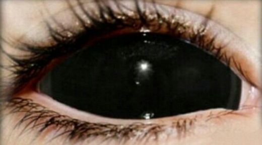 Lentes de contacto sclera.