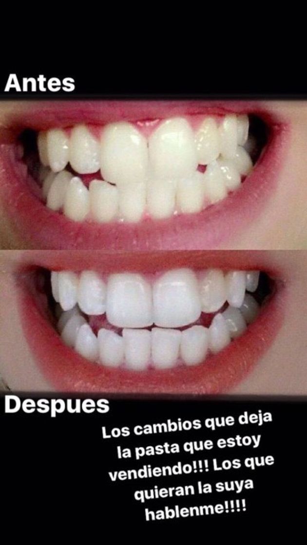 Fashion La mejor pasta dental con los mejores resultados 😍