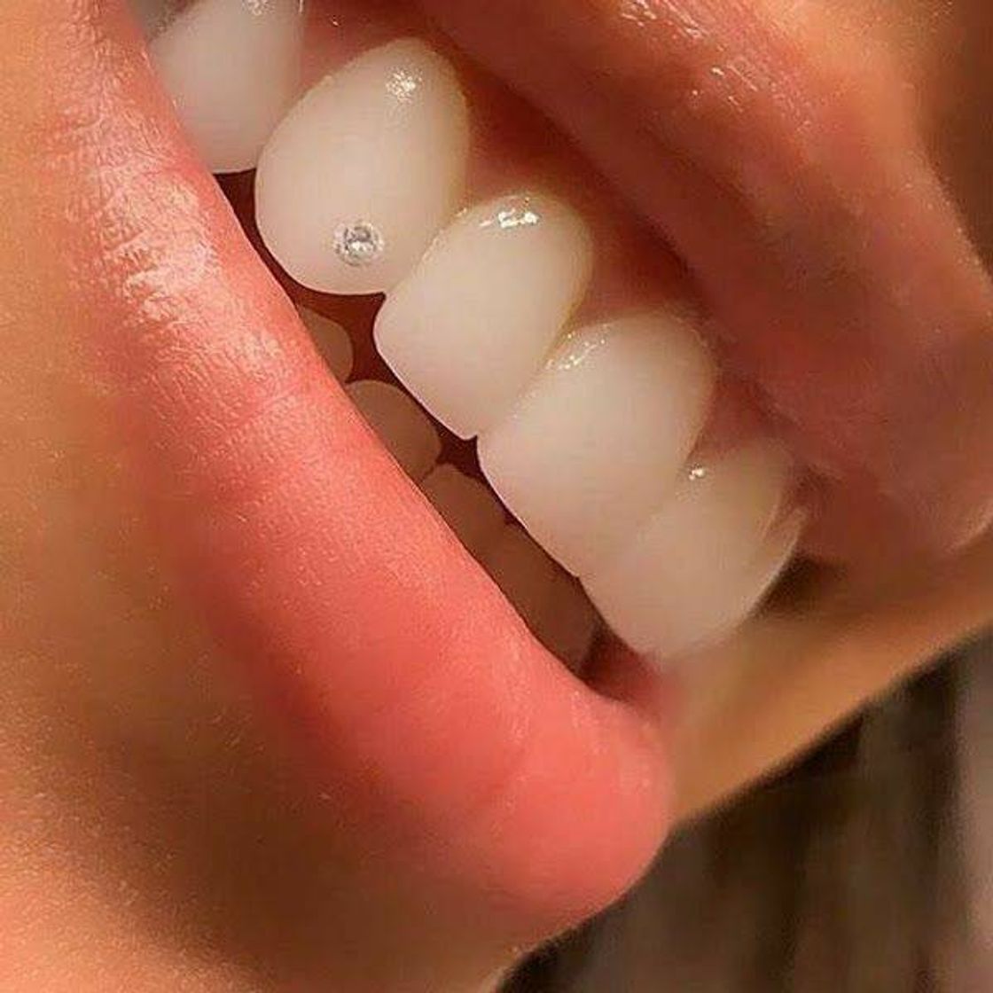 Moda Teeth piercing