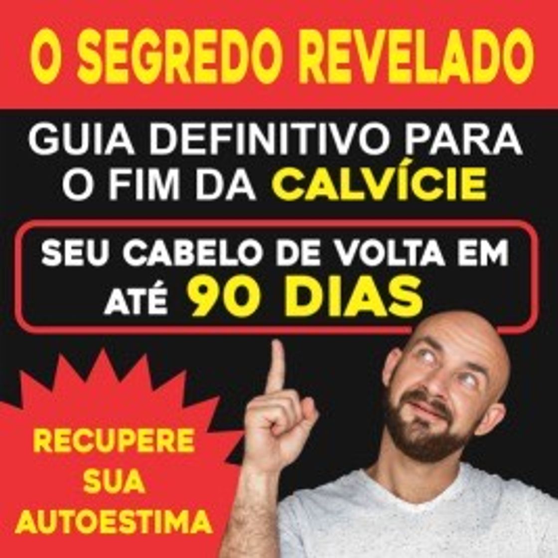 Fashion Guia definitivo para o fim da calvície