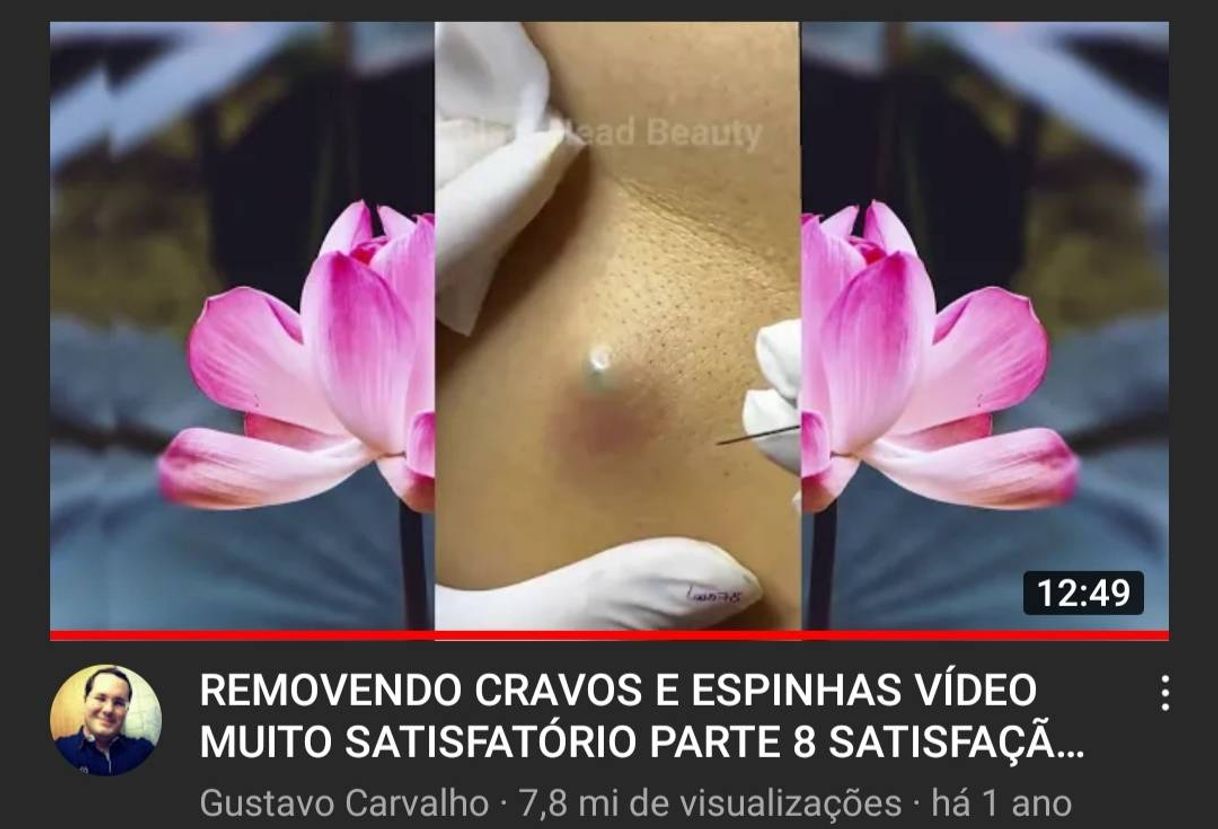 Cravo
