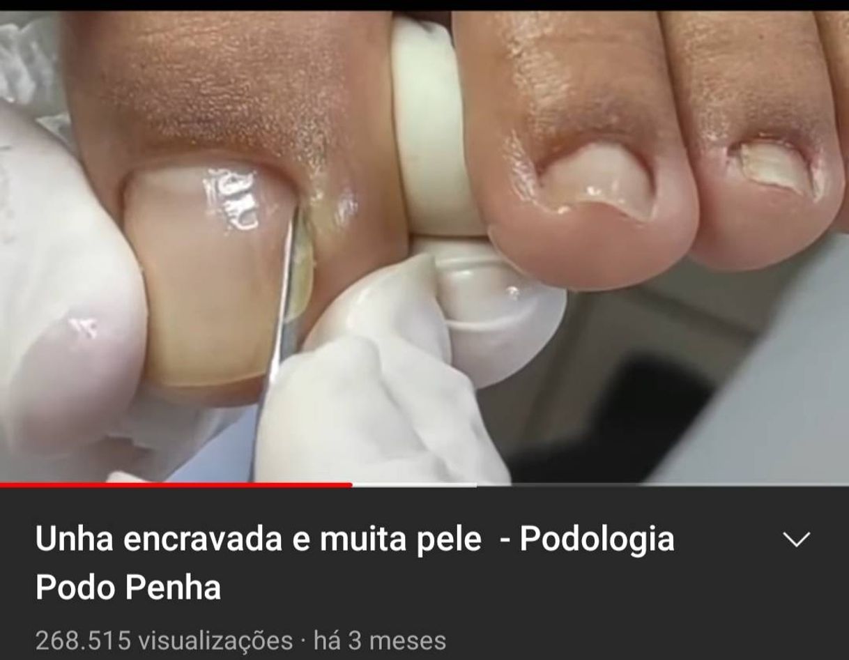 Unha envravada