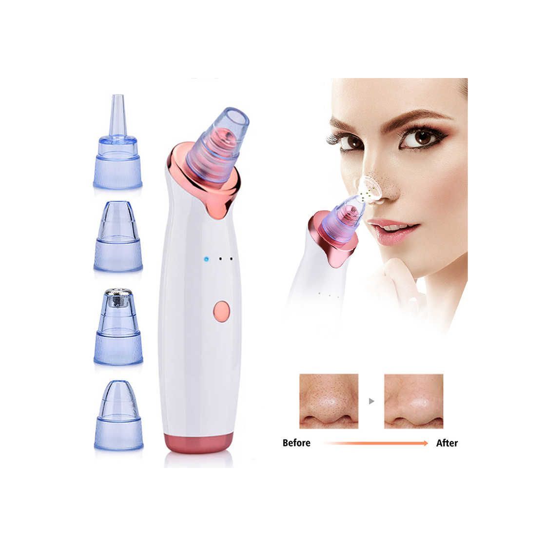 Social XMBT Aspirador removedor de espinillas