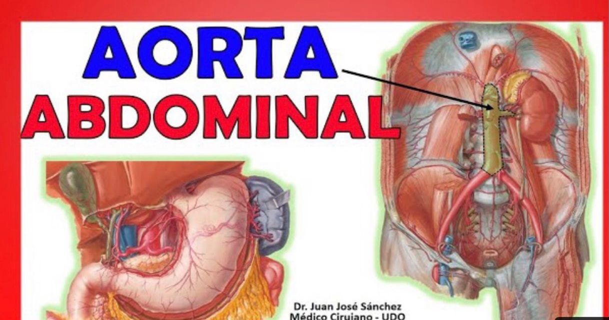 Fashion Aorta abdominal