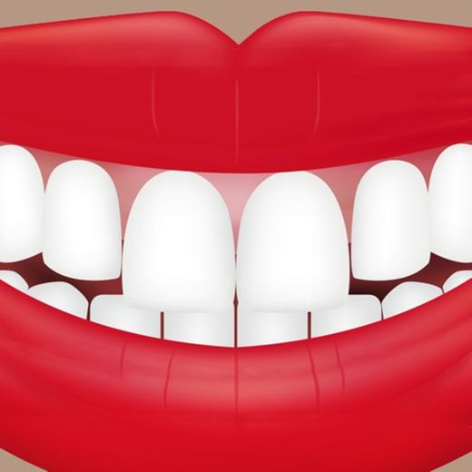 Teeth Whitener 2