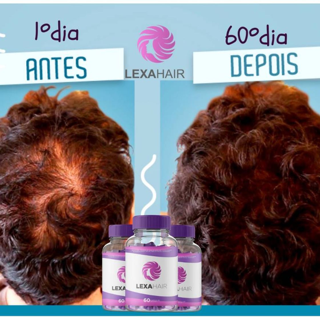 Social Queda de cabelo? Calvície? Quer deixar seu cabelo crescer?
