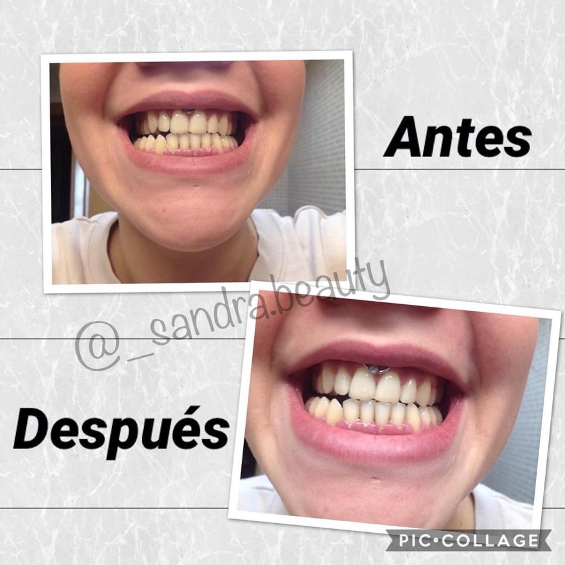 Social Resultados clientas