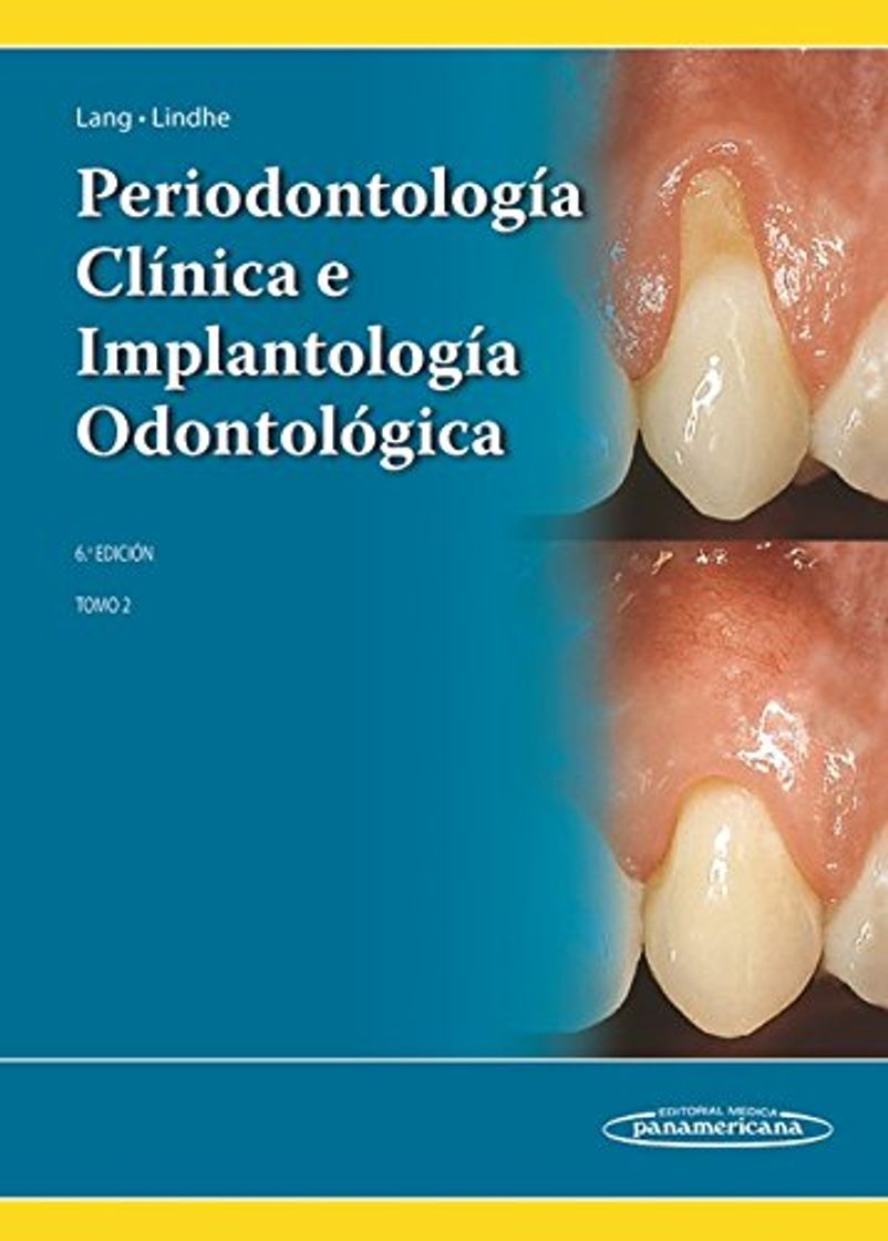 Libros Periodontología Clínica e Implantología Odontológica