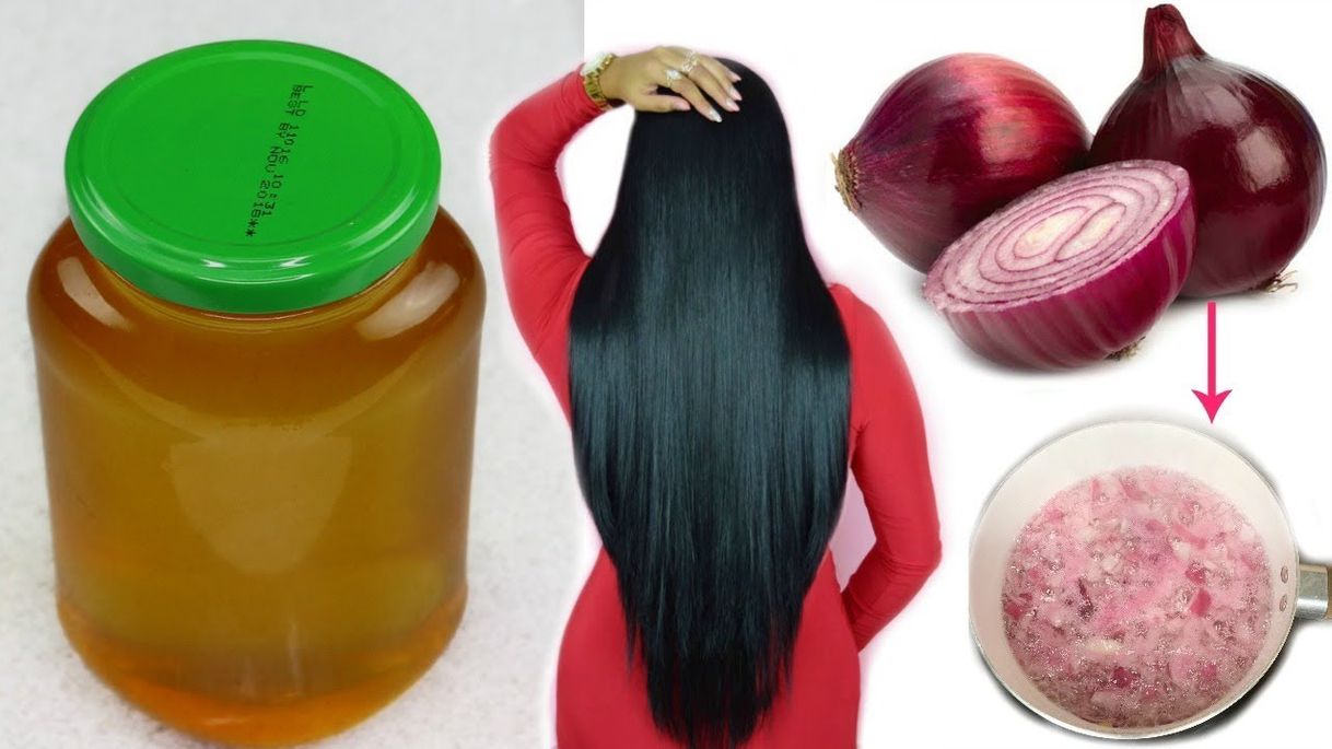Social Aceite de Cebolla Casero:Crecimiento extremo del cabello en 7 ...