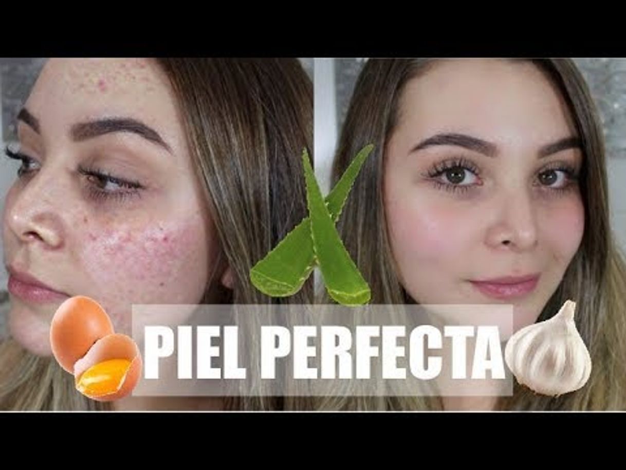 Fashion Remedios Naturales para una Piel Perfecta SIN ACNE! - YouTube