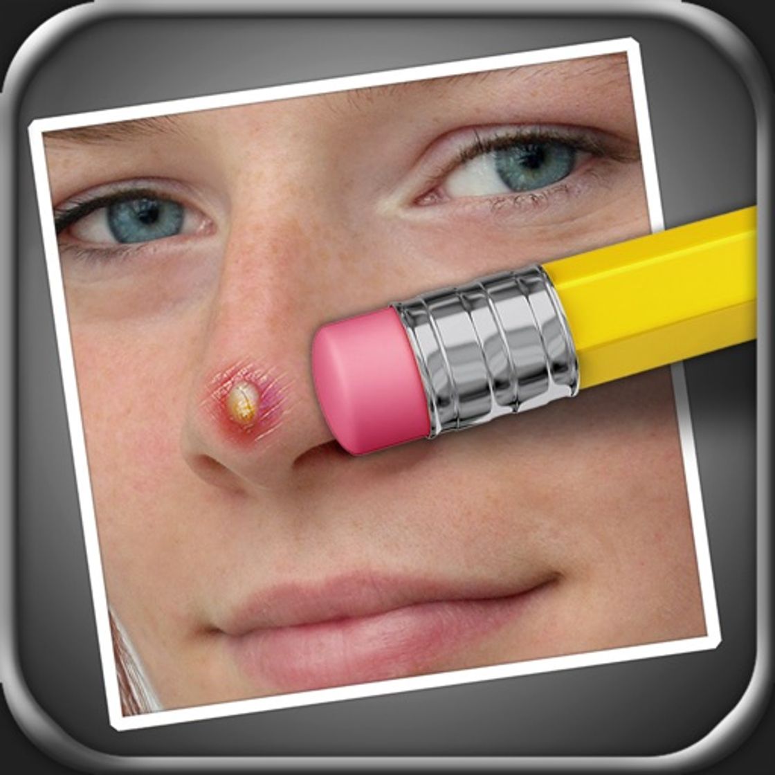 App Pimple Eraser