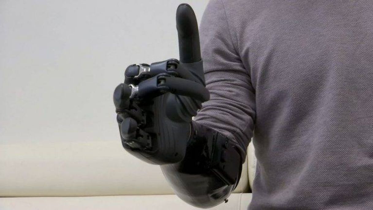 Producto BrainCo’s prosthetic hand