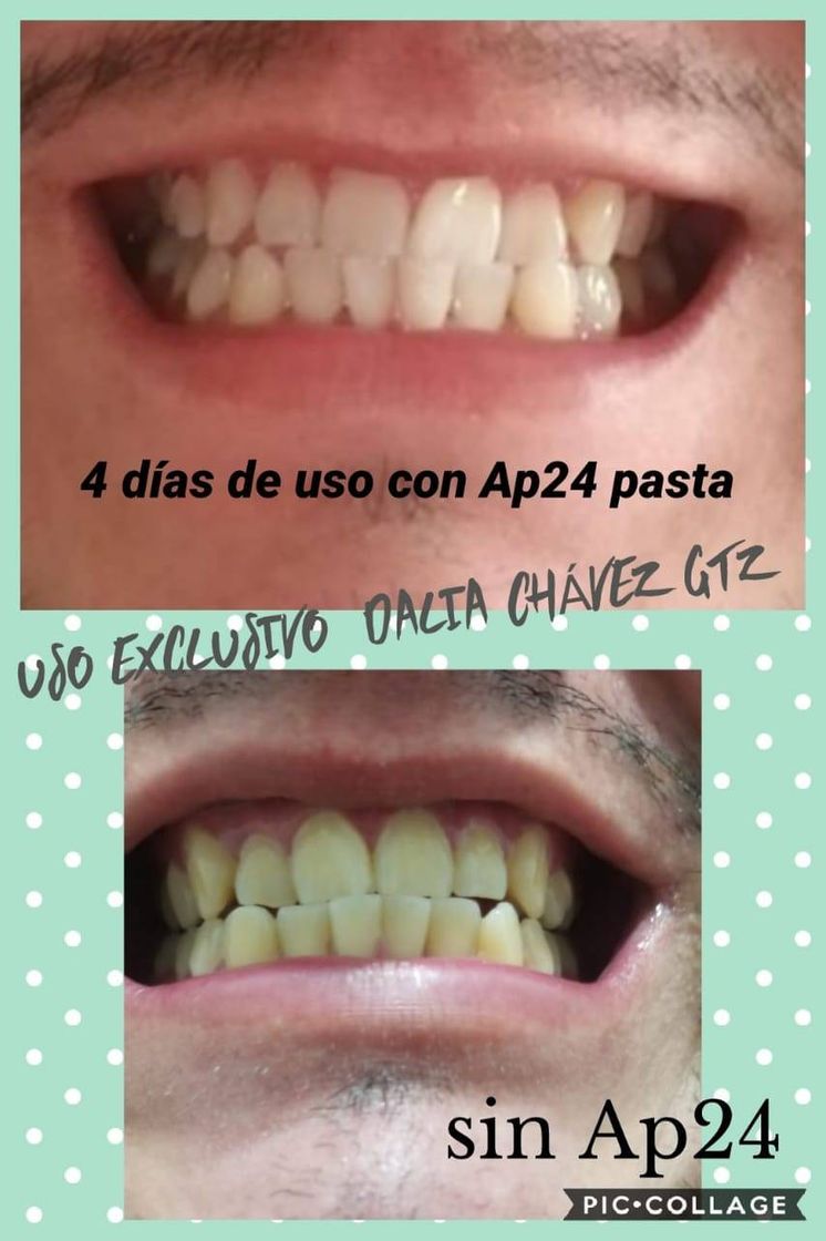 Moda Pasta de dentes branqueadora