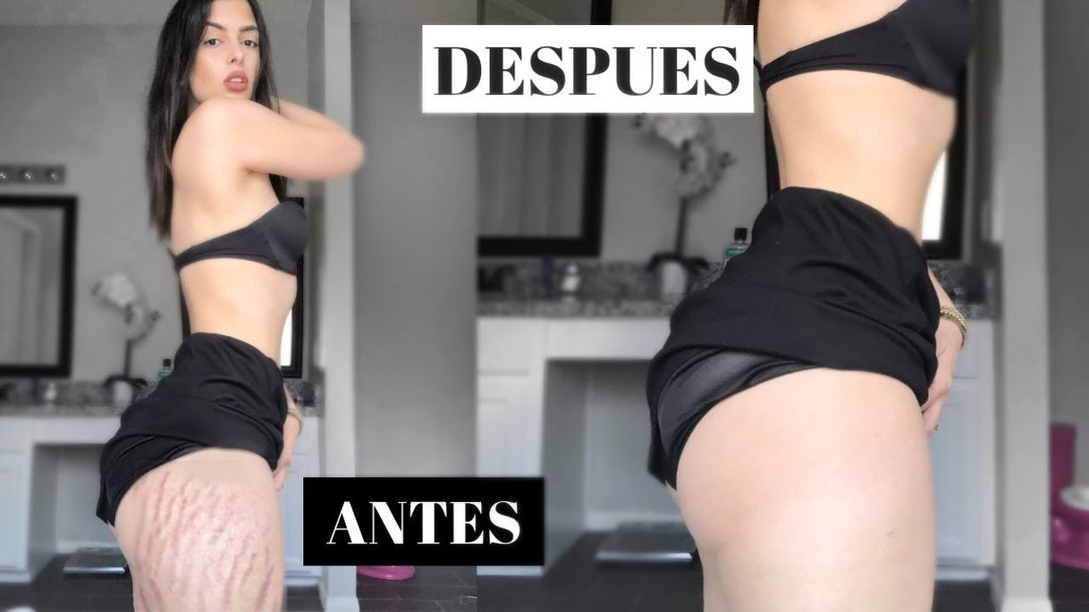 Social COMO QUITAR ESTRÍAS🙌