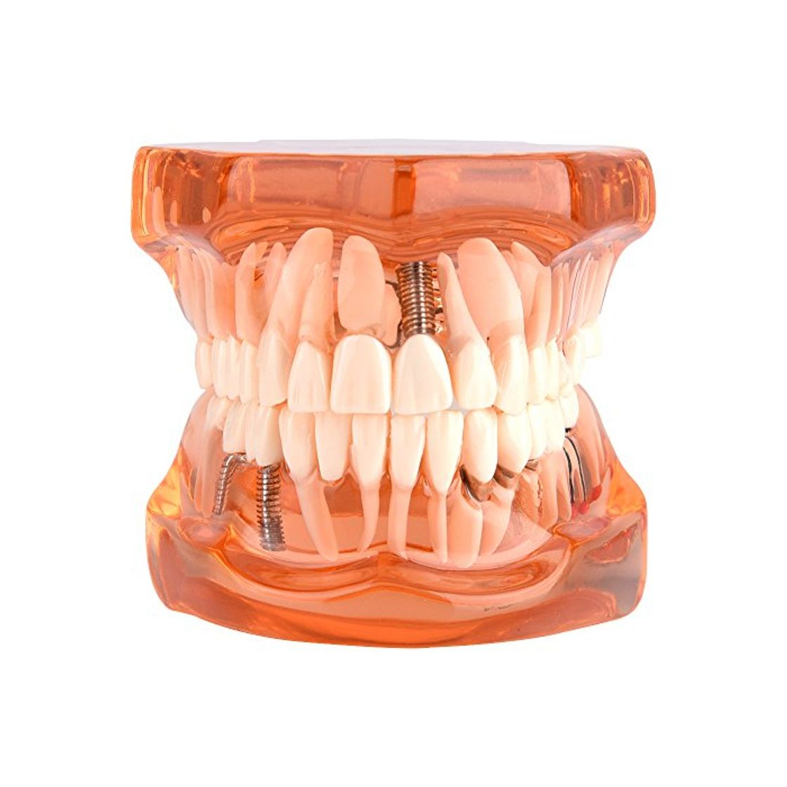 Product Walfront 1Pcs Modelo para Aprendizaje de Dentista Modelo de Dientes Dentadura Desmontable