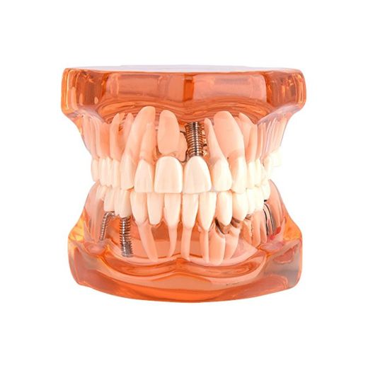 Walfront 1Pcs Modelo para Aprendizaje de Dentista Modelo de Dientes Dentadura Desmontable