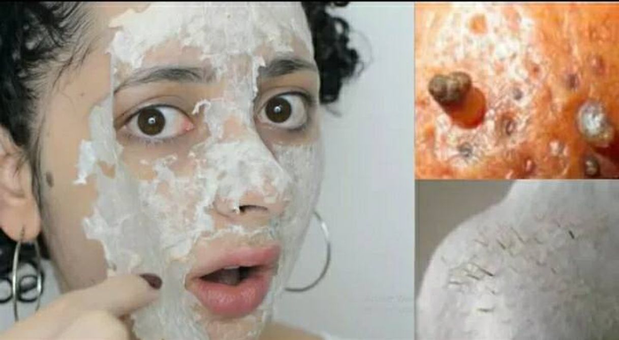 Social Adiós Puntos Negros (YouTube)