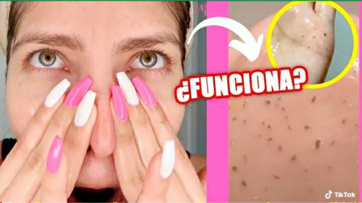 Social ¡Si funciona! Adiós puntos negros.