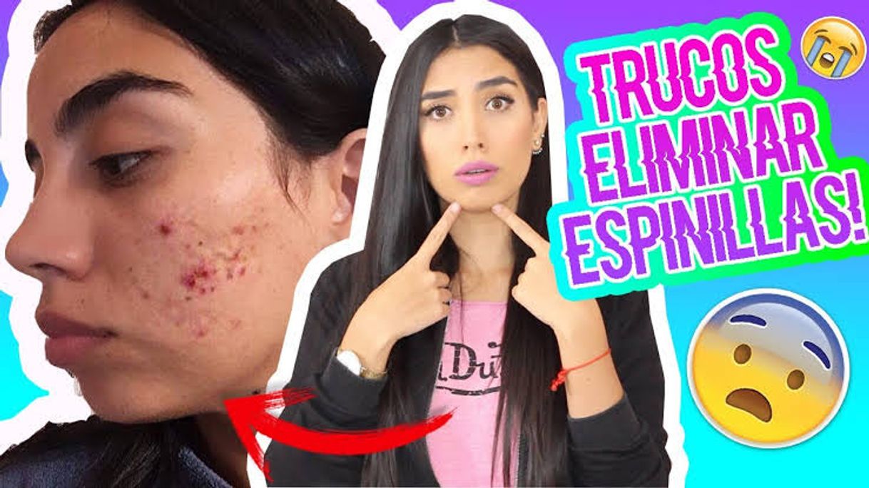 Social TRUCOS PARA ELIMINAR ESPINILLAS EN 1 NOCHE! | Claudipiaachic