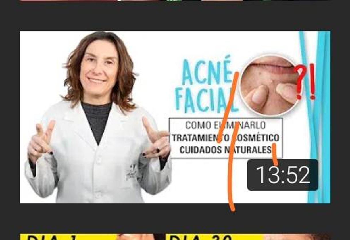Social 😱😱😱TRATAMIENTO PARA GRANOS EN LA CARA 😱😱