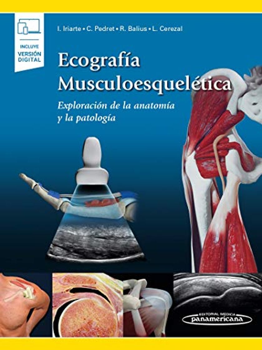 Book Ecografía musculoesquelética: Exploración De La Anatomía y La Patología