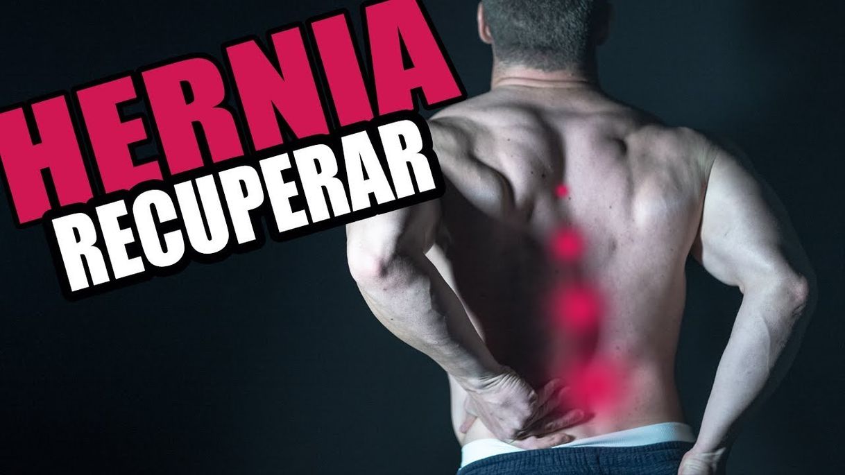 Social COMO RECUPERAR UNA HERNIA DISCAL (SIN CIRUGÍA ...