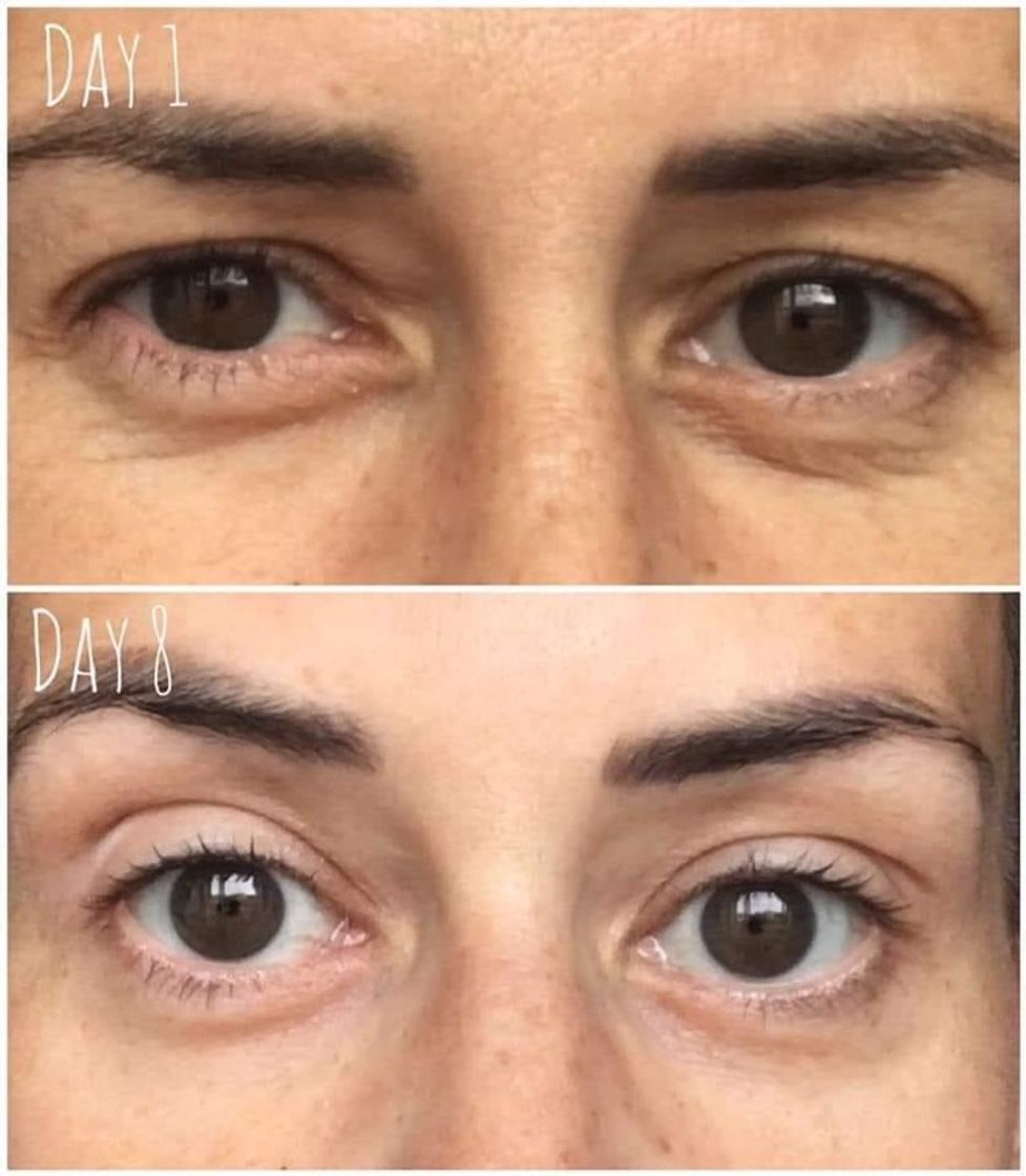 Crema para contorno de ojos 