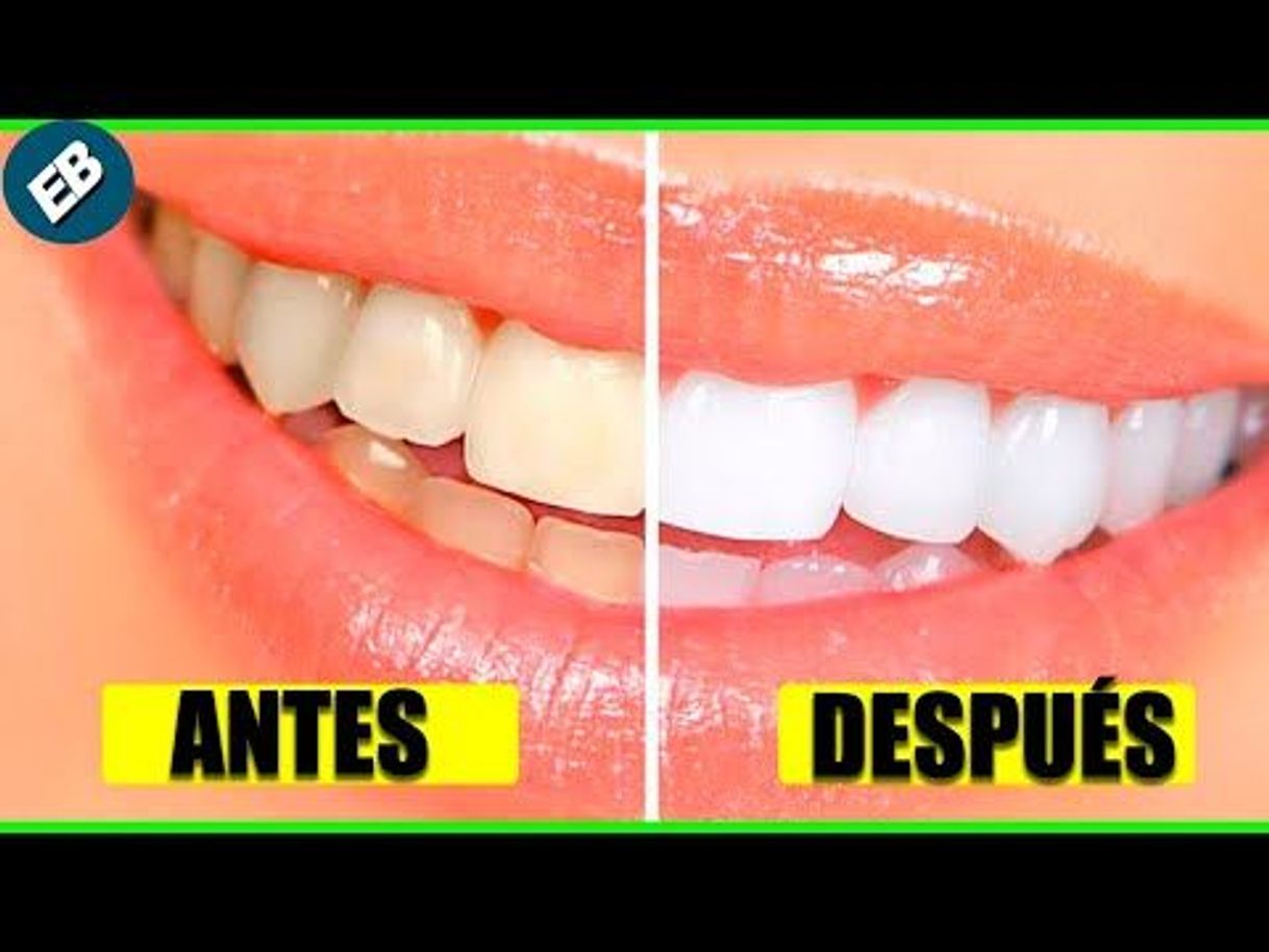 Fashion 10 formas naturales de blanquear los dientes amarillentos 