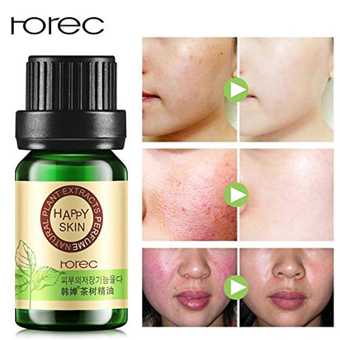 Productos ROREC 100% Tea Tree Compound Essential Oil Moisturizer Faical Oil-control Acne Treatment