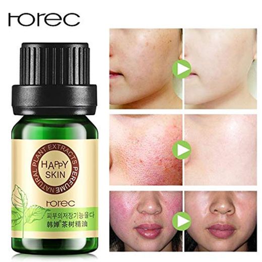 ROREC 100% Tea Tree Compound Essential Oil Moisturizer Faical Oil-control Acne Treatment