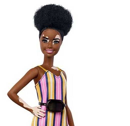 Barbie fashionista- 135 vitiligo 