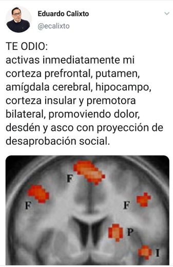 Muy inteligente e interesante todo lo q nos comunica 