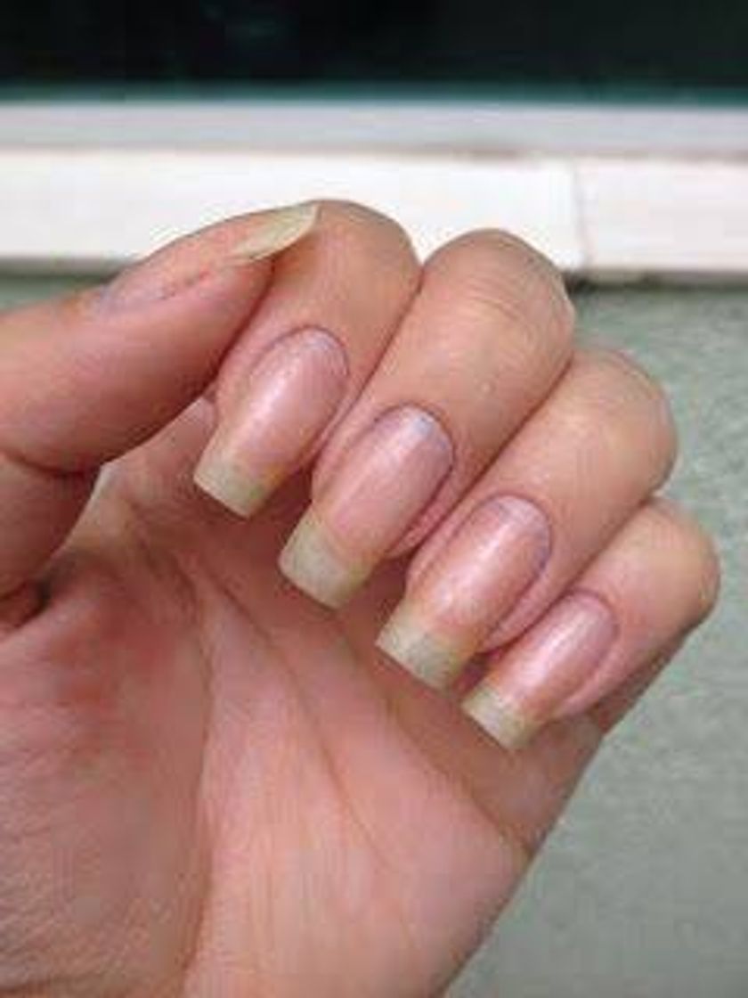 Social Receita E Dicas Para As Unhas✨