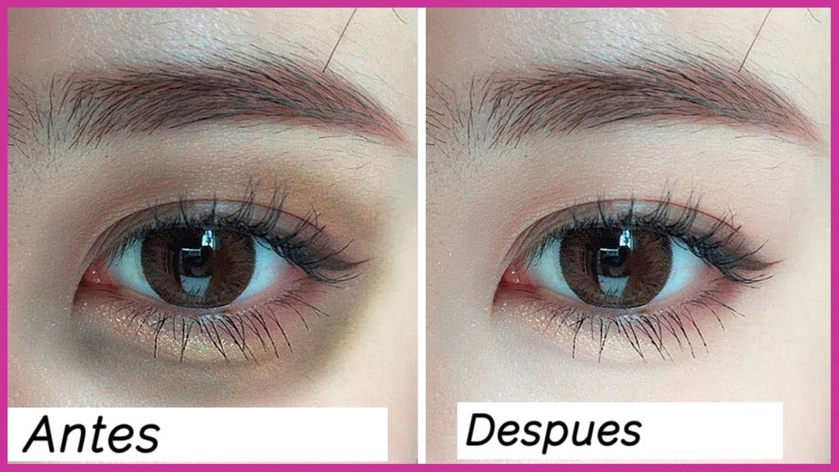 Moda Cómo Quitar las Ojeras en 3 días 