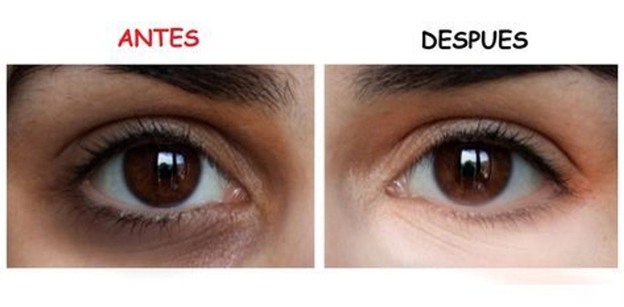 Moda Como eliminar las ojeras.