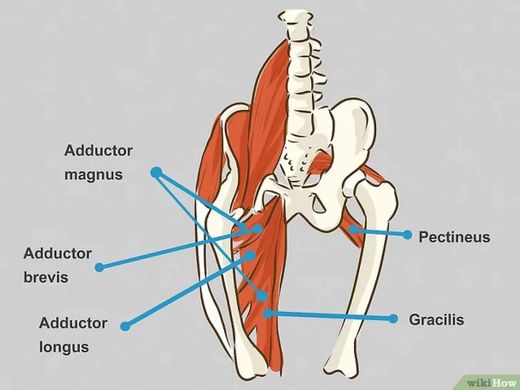 Distensión inguinal 