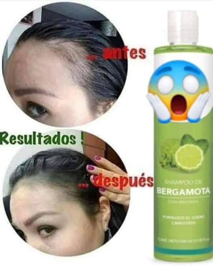 Fashion Shampoo de bergamota con minoxidil Sheló Nabel 💙