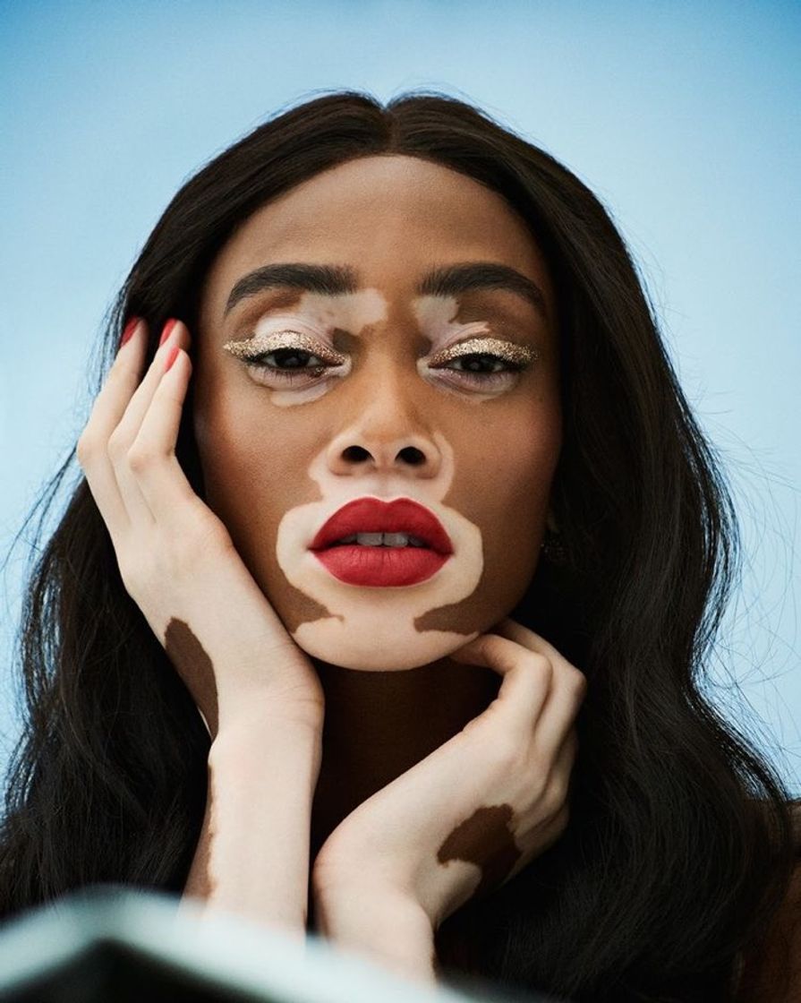Social Winnie Harlow