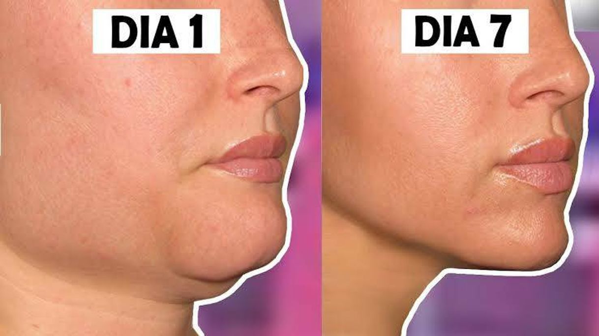 Social CÓMO ADELGAZAR LA CARA EN 1 SEMANA Y REDUCIR CACHETES YPAPAD