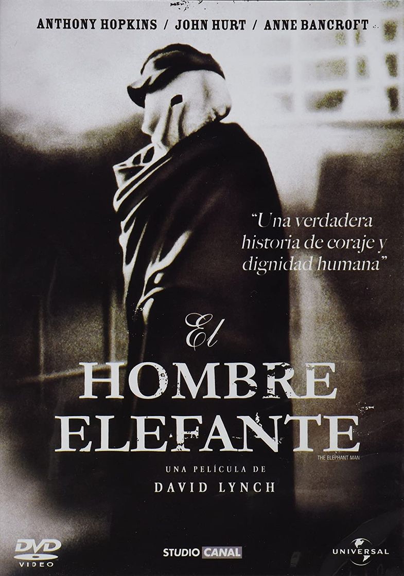 Serie El hombre elefante 