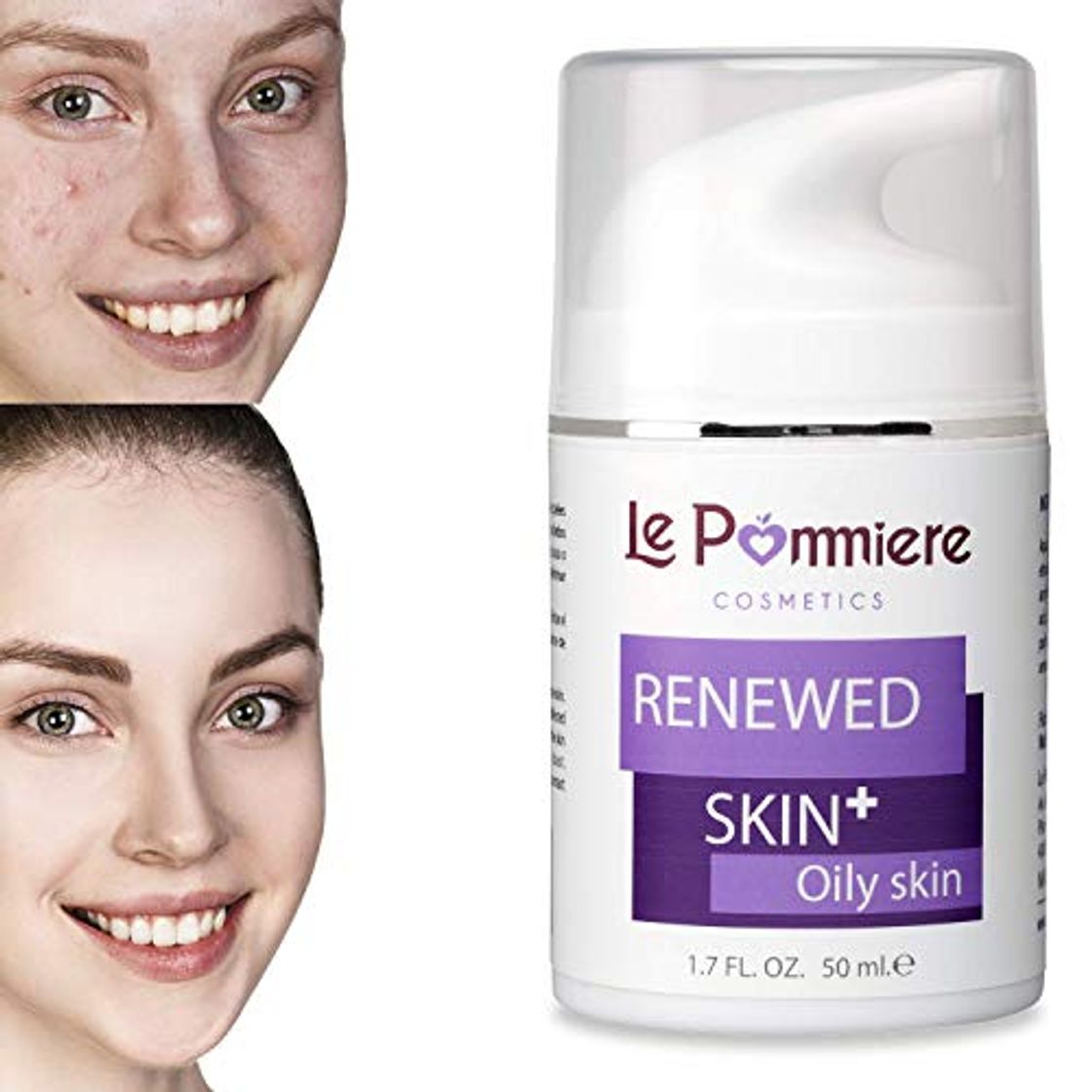 Social Le Pommiere Acné Gel 50ml, Ayuda a Remover Espinillas, Granos en Cara