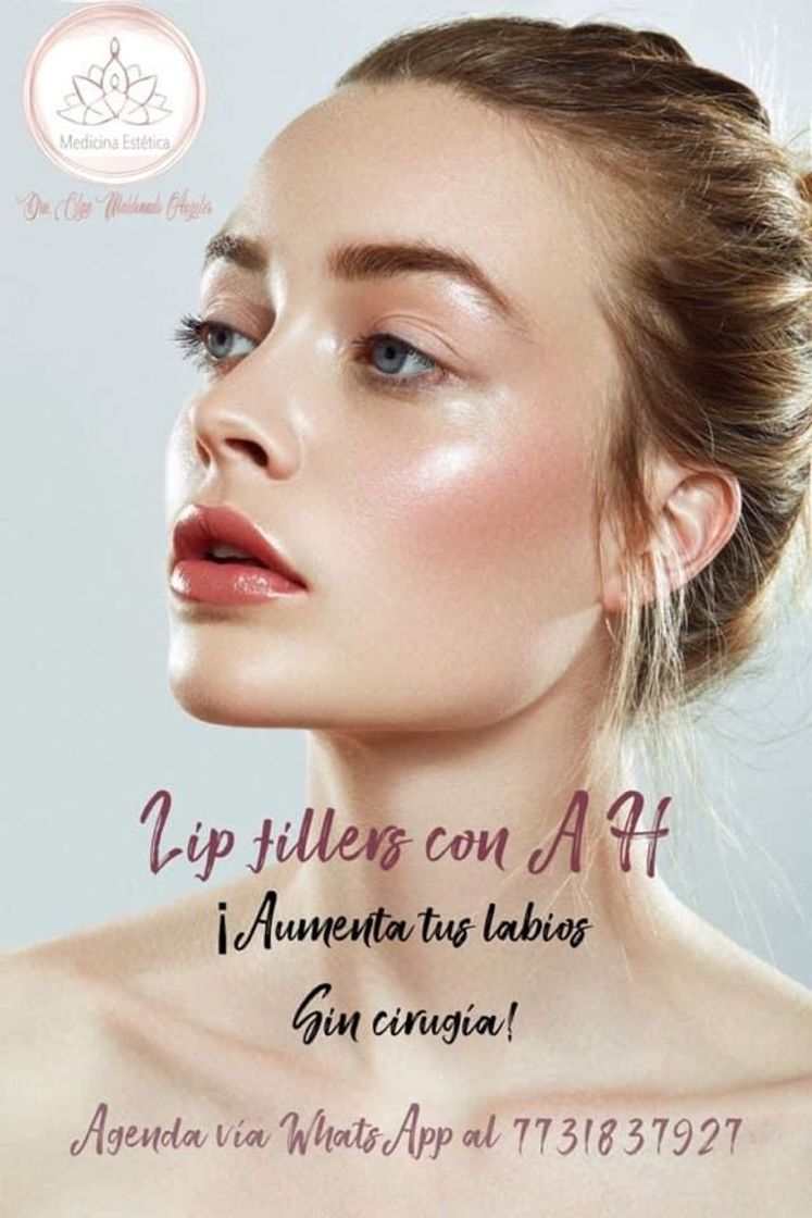 Fashion Lips filler