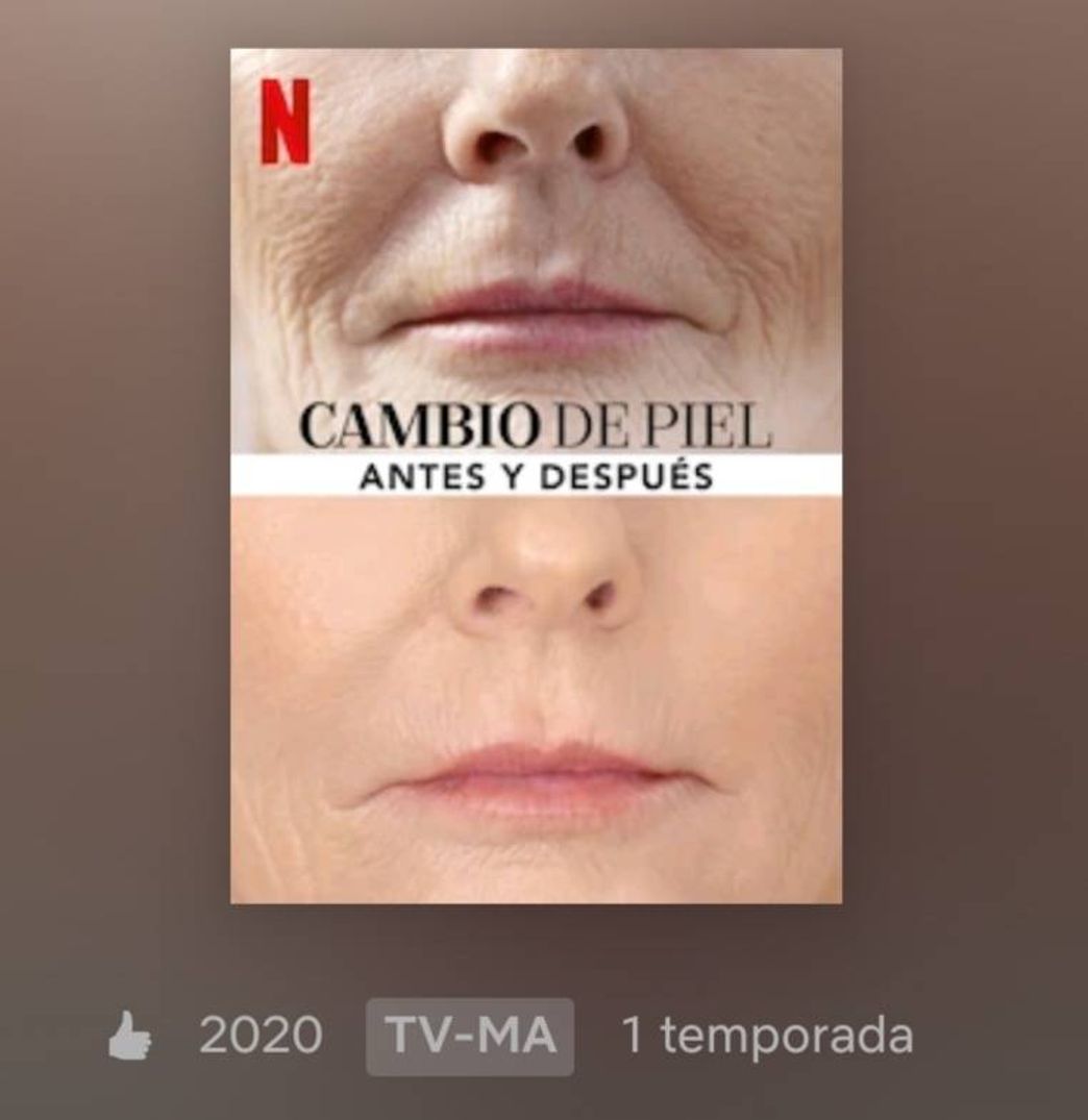 Serie Cambio de Piel