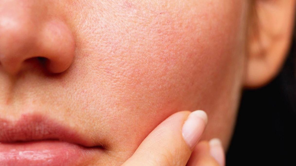 Social Mascarilla para piel seca 