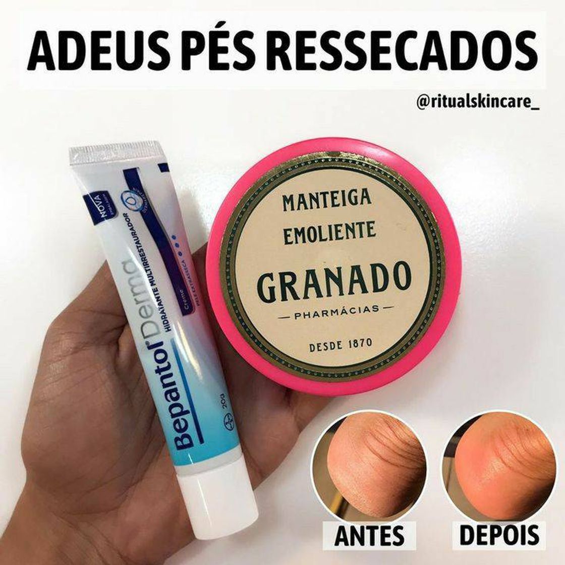 Moda Adeus pés ressecados 