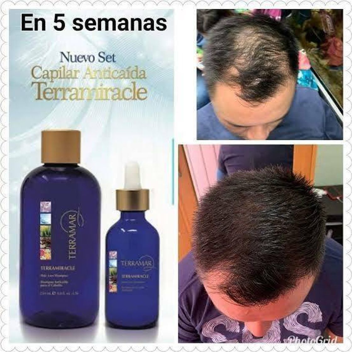 Set antocaida de cabello (shampoo y tonico) 