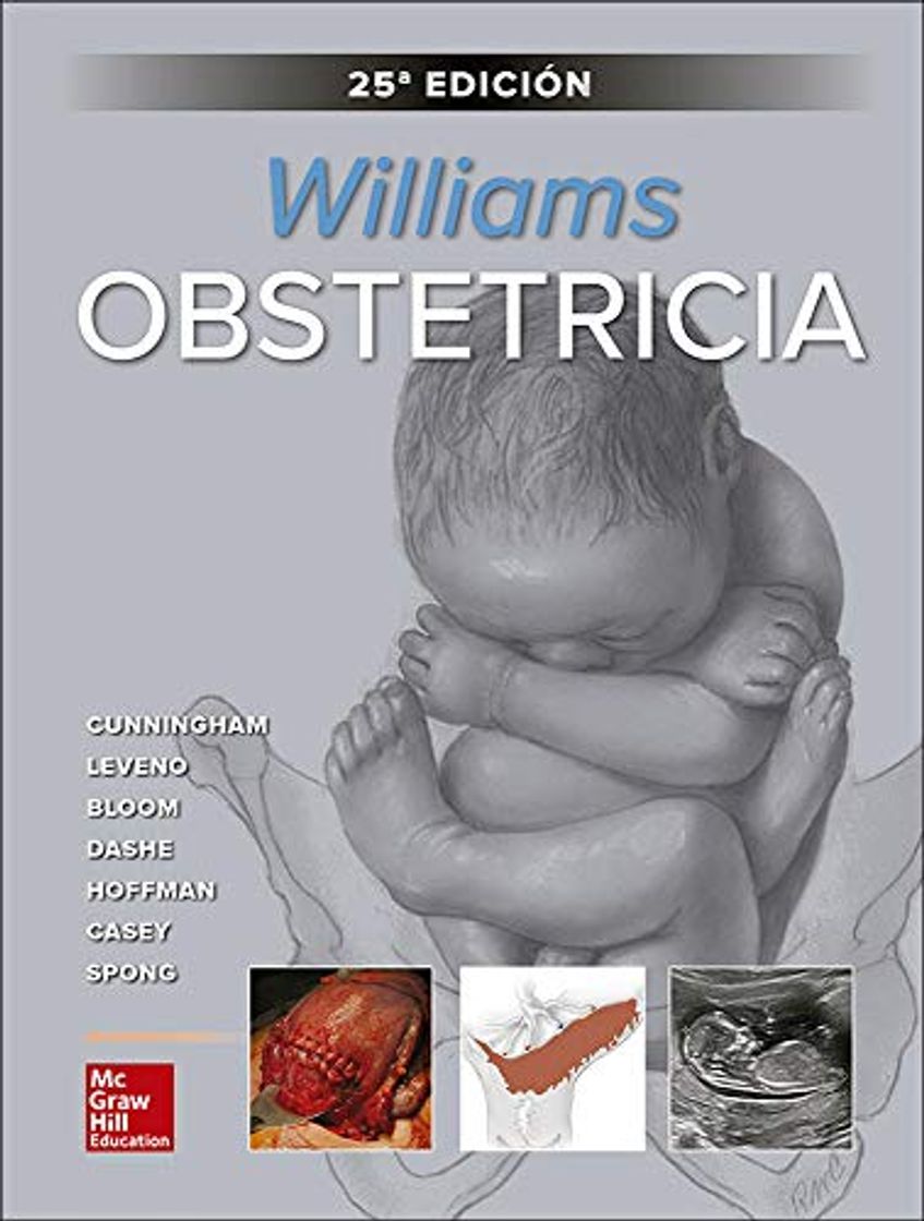 Books WILLIAMS OBSTETRICIA