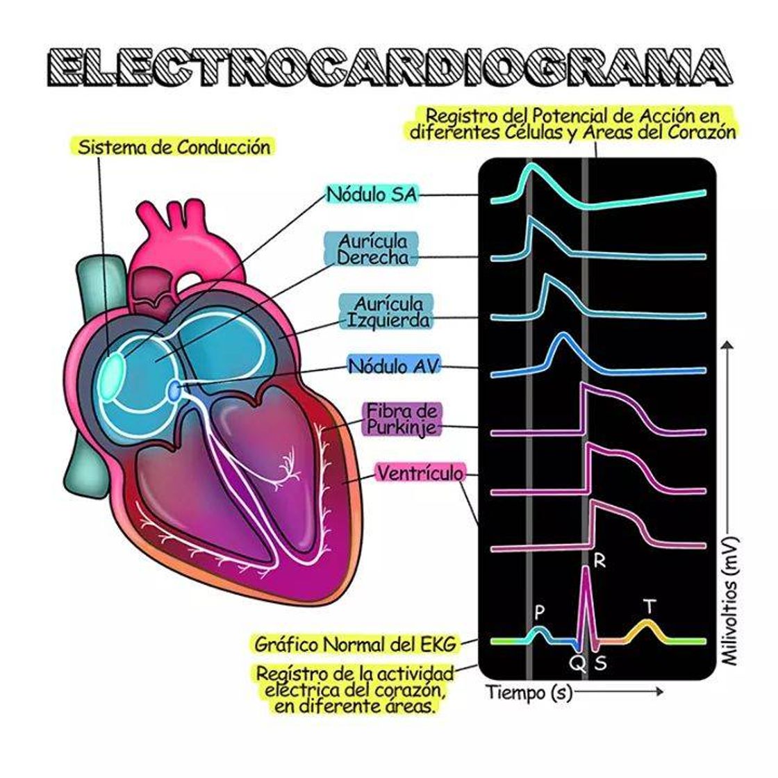 Fashion Electrocardiograma❤️