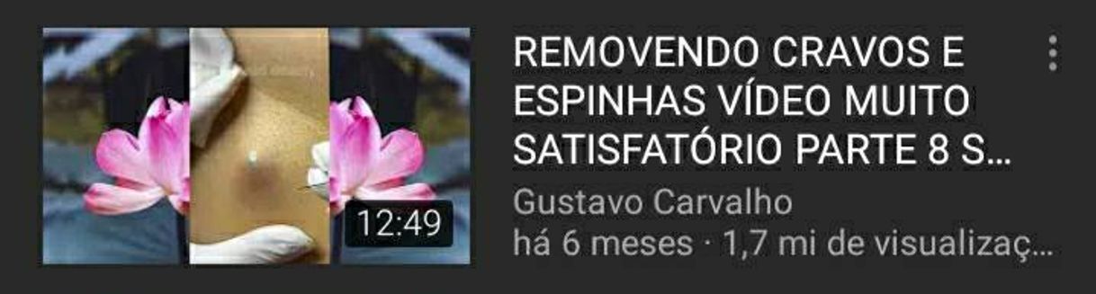 Fashion REMOVENDO CRAVOS E ESPINHAS VÍDEO MUITO ...